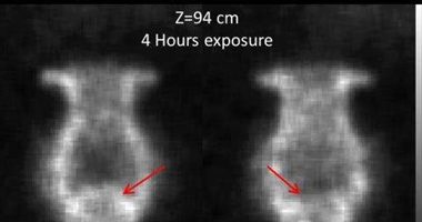 A new report from Phys.org explains how subatomic particles known as muons are being used to probe the structure of concrete. This is a useful ability because building materials such as pipes and concrete that are part of our energy infrastructure corrode and wear thin or degrade over time. Scientists were seeking a better way to be warned of infrastructure deterioration before it becomes a problem and found that these particles work.