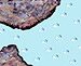 As an alternative to ordinary concrete mixtures, high reactivity metakaolin can be used to replace 5 percent to 20 percent of the portland cement in a mixture. The small size of the metakaolin particles fills in the gaps between cement particles to create a denser and creamier cement paste.